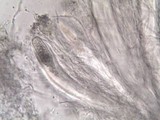 Pertusaria multipuncta image