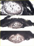 Pertusaria leioplaca image