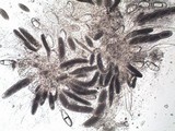 Pertusaria leioplaca image