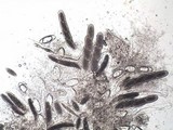 Pertusaria leioplaca image