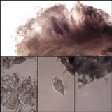 Arthonia elegans image