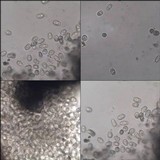 Abrothallus welwitschii image