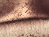 Lecanora rubicunda image