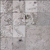 Caloplaca variabilis image