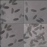 Pyrenula macrospora image