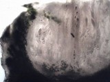 Pertusaria hymenea image