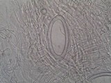 Pertusaria hymenea image