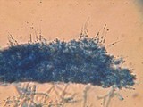 Phlebia subulata image