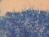 Phlebia subulata image