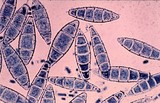 Microsporum gypseum image