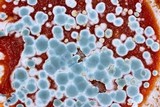 Penicillium italicum image