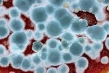 Penicillium italicum image