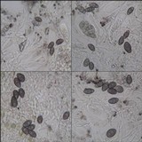 Rinodina oleae image