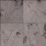 Schismatomma graphidioides image