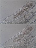 Pertusaria heterochroa image
