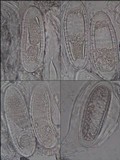 Pertusaria heterochroa image