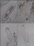 Pertusaria heterochroa image