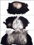 Pertusaria pustulata image