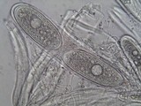 Pertusaria pustulata image