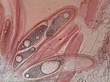 Pertusaria pustulata image