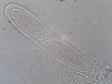 Pertusaria pustulata image