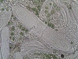 Pertusaria pustulata image