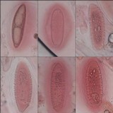 Pertusaria pustulata image