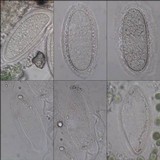 Pertusaria pustulata image