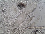 Pertusaria pustulata image