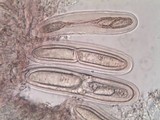 Pertusaria pustulata image