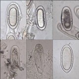 Pertusaria pustulata image