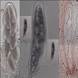 Pertusaria hymenea image