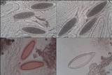 Pertusaria hymenea image