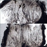 Pertusaria heterochroa image