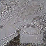 Pertusaria heterochroa image