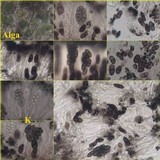 Buellia subdisciformis image