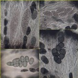 Rhizocarpon badioatrum var. badioatrum image
