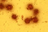 Scleroderma cepa image