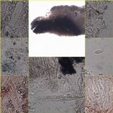 Opegrapha durieui image