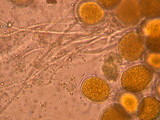 Endogone pisiformis image