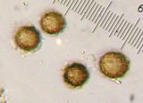 Scleroderma polyrhizon image