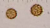 Scleroderma areolatum image