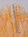 Ascocoryne sarcoides image
