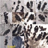 Buellia leptocline image