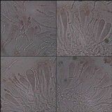 Aspicilia radiosa image