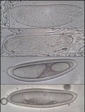 Pertusaria pertusa image