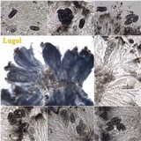Amandinea lecideina image
