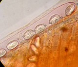 Scutellinia umbrorum image