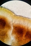 Chlorencoelia versiformis image