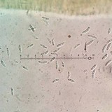 Chlorencoelia versiformis image
